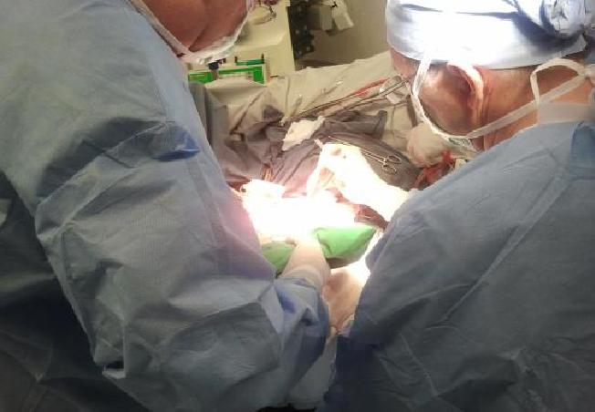 Wszczepienie protezy Codubix 3D_5