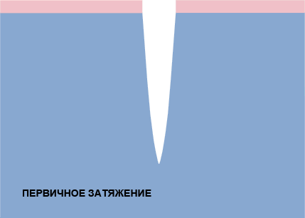 Лечение ран